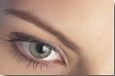 Brow Lift Photos