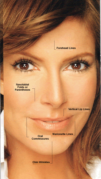 juvederm photo