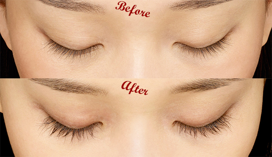 Latisse before and after photo.