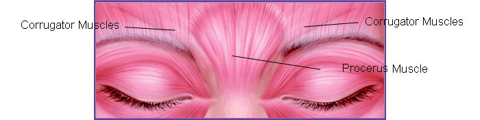 botox diagram