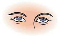 cosmetic eyelid surgeon
